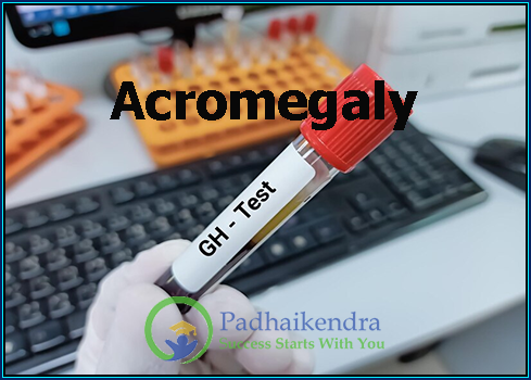 Acromegaly
