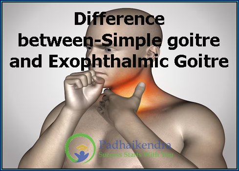 Difference between-Simple Goitre and Exophthalmic Goitre