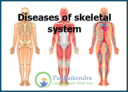 Diseases of skeletal system