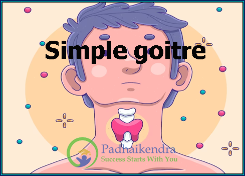 Simple goitre